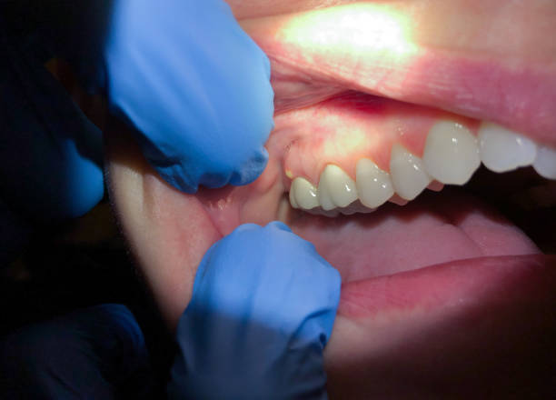 Best Cosmetic Emergency Dentistry in Floris, VA